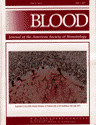 Blood Cover Image for Volume 89, Issue 9