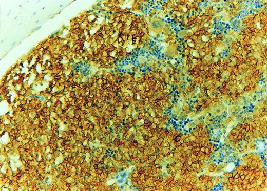 Blood Cover Image for Volume 92, Issue 4