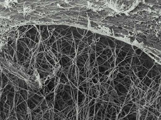 Blood Cover Image for Volume 92, Issue 6