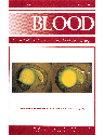 Blood Cover Image for Volume 93, Issue 2