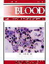 Blood Cover Image for Volume 93, Issue 7