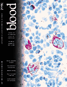 Blood Cover Image for Volume 95, Issue 10