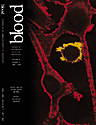 Blood Cover Image for Volume 95, Issue 11