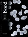 Blood Cover Image for Volume 97, Issue 2
