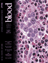 Blood Cover Image for Volume 97, Issue 5