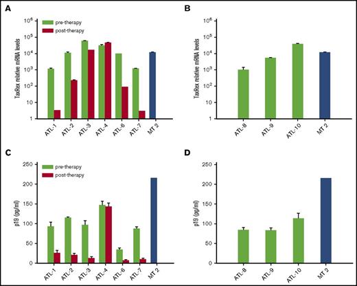 Figure 1. tax/rex expression and p19 detection in samples from short-term PBMC cultures of ATL patients pre– and post–in vivo therapy with AZT/IFN. (A) tax/rex messenger RNA (mRNA) expression was detected by quantitative real-time PCR from cells collected after 7 days of short-term PBMC cultures of ATL patients. The results represent the mean values of triplicate samples expressed as relative tax/rex mRNA expression ± standard deviation (SD) in log scale, with respect to the untreated samples with least tax/rex expression. (B) tax/rex mRNA expression, detected and expressed as in panel A, referring to diagnostic samples from ATL patients (ATL 8, 9, 10). (C) p19 level (mean ± SD of quadruplicate samples, in picograms per milliliter) measured by antigen capture assay in pools of PBMC culture supernatants from each ATL patient or control HTLV-1–transformed cell line MT-2. (D) p19 level, detected and expressed as in panel C, referring to diagnostic samples from ATL patients (ATL 8, 9, 10).