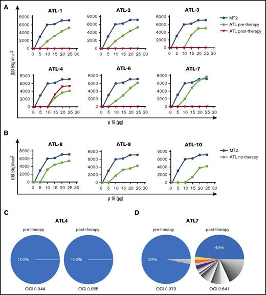 Figure 2. HTLV-1 RT activity and clonality analysis in samples from short-term PBMC cultures from ATL patients pre– and post–in vivo therapy with AZT/IFN. (A) Serial amounts of 5 to 25 pg p19-equivalent RT preparations obtained from supernatants of short-term cultured PBMCs from ATL patients, pre– and post–in vivo therapy with AZT/IFN, were added in the quantitative real-time PCR and HTLV-1 RT activity was assessed. The yield of PCR-amplified products, quantified by densitometry, is shown on the vertical axis. HTLV-1 RT activity in RT preparations obtained from supernatants of MT-2 cells was assayed as a control. (B) HTLV-1 activity, detected and expressed as in panel A, referring to diagnostic samples from ATL patients (8, 9, 10). (C-D) HTLV-1 clonality analysis. The relative abundance of HTLV-1–infected T-cell clones was quantified by linker-mediated PCR and high-throughput sequencing, as previously described.21 Each sector of the pie chart denotes a single clone of HTLV-1–infected cells, a clone being defined by the genomic integration site of the (single-copy) provirus. Clones with a relative abundance >1% are colored; lower-abundance clones are shown in gray. The width of each sector indicates the relative abundance of that clone. An OCI > 0.7 is characteristic of ATL.22 The HTLV-1 proviral loads were as follows: ATL4 (pretherapy, 57.12%; posttherapy, 53.47%); ATL7 (pretherapy, 11.65%; posttherapy, 13.93%). OD-Bkg, optical density–background.