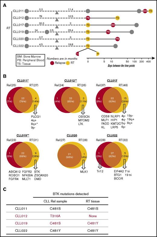 Figure 4. Clonal evolution in CLL-RT transition. (A) Schematic representation of the paired samples used for this analysis: orange for RT and red for liquid sample. (B) Venn diagrams comparing the genetic lesions in the paired RT and relapse samples of each patient. Numbers indicates counts of mutations. (C) Comparison of BTK mutations present in CLL vs RT tissue. *CLL011 showed gains of MYC in liquid relapse sample (Rel), but the copy number was further increased in the RT tissue. **No CNA data were available from the RT samples of patients CLL012 and CLL019. Tri, trisomy.