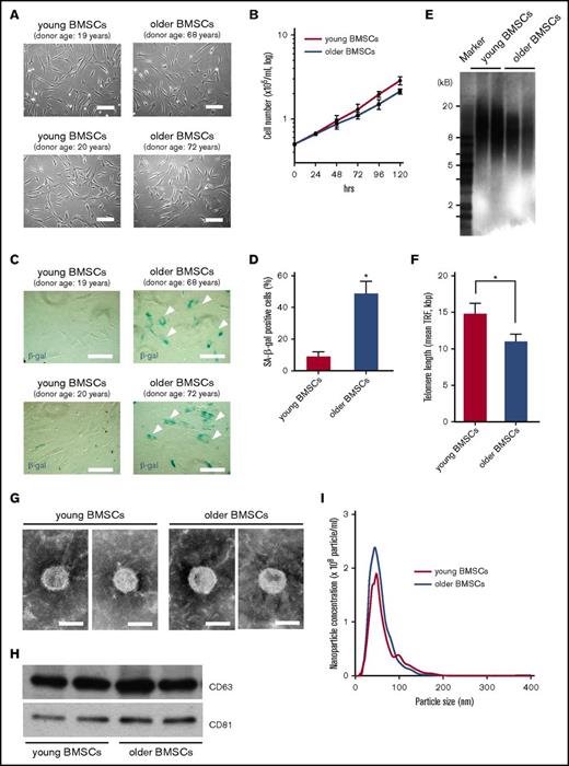 Figure 1. Characterization of BMSCs. (A) Morphology of BMSCs derived from 2 young healthy donors (young BMSCs; passage 2; donor ages: 19 and 20 years old) and 2 older healthy donors (older BMSCs; passage 2; donor age: 68 and 72 years) by phase-contrast inverted microscopy. Scale bar, 50 µm. (B) BMSC growth measured after 24, 48, 72, 96, and 120 h in culture. Cell proliferation of young BMSCs (pink line) and older BMSCs (blue) was evaluated. Each value represents the mean ± SD (n = 6). (C-D) Representative images of SA-β-gal staining (arrows indicate positive cells) and quantification of cell senescence. Data represent the mean ± SD. *P < .01 in comparison with young BMSCs using a Student t test. Scale bar, 50 µm. (E-F) Telomere lengths in young and older BMSCs determined by Southern blotting of TRFs. Data represent the mean ± SD. *P < .05 in comparison with young BMSCs using a Student t test. (G) Transmission electron micrographs of exosomes derived from young and older BMSCs. Scale bar, 50 nm. (H) Western blots of exosomal lysates (CD63 and CD81 are common exosomal markers) derived from young and older BMSCs. Exosomes were isolated from 5 mL of culture medium collected from BMSCs (4 × 104 cells/cm2) grown for 48 h. Equal volumes of exosomal lysate (30 µL) were loaded in the lanes of gels. (I) Nanoparticle concentration and size distribution of exosomes derived from young BMSCs (pink line) and older BMSCs (blue line).