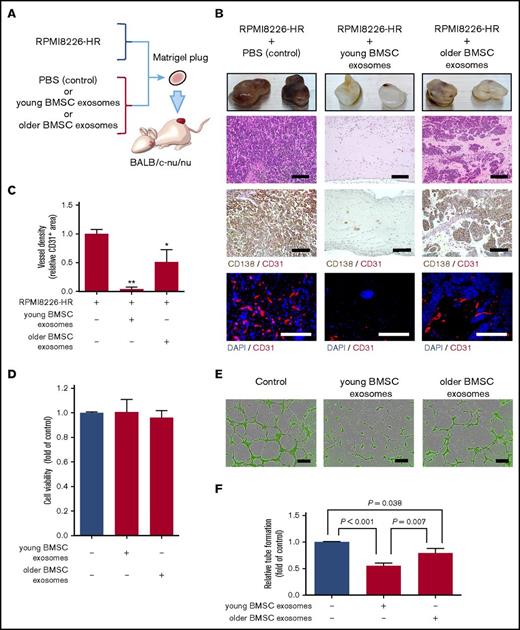 Figure 2. Healthy BMSC exosomes inhibit HR-MM cell-induced angiogenesis in Matrigel plugs. (A) Schematic of the Matrigel plug assay. A mixture of Matrigel and 4 × 106 RPMI8226-HR cells was admixed with exosomes derived from young BMSCs (young BMSC exosomes; 4 × 107 particles per 200 µL Matrigel) or older BMSCs (older BMSC exosomes; 4 × 107 particles per 200 µL Matrigel). (B) After 3 weeks, the Matrigel plugs were harvested and photographed. Paraffin-embedded sections of Matrigel plugs were stained with hematoxylin and eosin and then subjected to immunostaining for CD138 (brown) and CD31 (red). Cell nuclei were stained with 4′,6-diamidino-2-phenylindole (DAPI) (blue). Scale bar, 500 µm. (C) Quantification of vessel density in Matrigel plugs by pixel density. Young and older BMSC exosomes inhibited tumor angiogenesis in Matrigel plugs compared with the control (RPMI8226-HR only) (*P < .01; **P < .001 vs control, Student t test, n = 6). Values represent the mean ± SD. (D) Effect of BMSC exosomes on the viability of HR-MM cells. RPMI8226-HR cells were cultured with young or older BMSC exosomes (2.5 × 107 particles/mL). Cell viability was assayed after 48 h using Cell Counting Kit-8. Values represent the mean ± SD. (E) The formation of tube-like structures was observed using the cell-permeable dye Calcein AM (green). Endothelial tube formation of HUVECs treated with young BMSC exosomes, older BMSC exosomes, or the control (without exosomes). Scale bar, 500 µm. (F) Quantification of tube-like structures by pixel density. Young and older BMSC exosomes significantly inhibited HUVEC tube formation in comparison with the control (control vs young BMSC exosomes; P < .001, control vs older BMSC exosomes; P = .038, Student t test). Values represent the mean ± SD.
