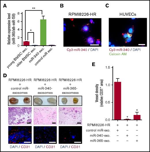 Figure 4. Antiangiogenic effects of modified exosomes in vivo. (A) Exosomal miR-340 expression levels in young BMSC exosomes, older BMSC exosomes, and miR-340 exosomes were quantified by reverse transcription polymerase chain reaction (young BMSC exosomes vs older BMSC exosomes; *P < .01, young BMSC exosomes vs miR-340 exosomes; **P < .001, Student t test). Values represent the mean ± SD. (B-C) Recipient cells were treated with exosomes directly transfected with Cy3-miR-340 mimics. Cy3-miR-340 signals were detected in the cytoplasm of RPMI8226-HR cells (B) and HUVECs (C). Nuclear and cytoplasmic staining were performed with DAPI (blue) and Calcein AM (green), respectively. Scale bar, 25 µm. (D) A mixture of Matrigel and 4 × 106 RPMI8226-HR cells was admixed with older BMSC exosomes directly transfected with miR-340 mimics (miR-340 exosomes; 4 × 107 particles per 200 µL Matrigel), miR-365 mimics (miR-365 exosomes; 4 × 107 particles per 200 µL Matrigel), or negative control miR (control miR exosomes). The Matrigel mixture was injected subcutaneously into nude mice. Three weeks after implantation, the Matrigel plugs were harvested. Paraffin-embedded sections of Matrigel plugs were stained with hematoxylin and eosin and then subjected to immunostaining for CD31 (red). Scale bar, 500 µm. (E) Quantification of vessel density in Matrigel plugs by pixel density. Both mir-340 and miR-365 exosomes inhibited tumor angiogenesis in Matrigel plugs in comparison with the control (*P < .001 vs control, Student t test, n = 6). Values represent the mean ± SD. Exo, exosomes.