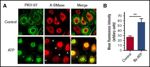 Figure 4. ATP induces translocation of A-SMase to the plasma membrane in macrophages. (A) MDMs were treated with a control vehicle or BzATP (200 µM) for 10 minutes. The cells were fixed, permeabilized, and stained for A-SMase using A-SMase–specific antibodies followed by secondary antibodies conjugated with AF567 fluorescent dye. During the secondary antibody labeling, the cells were also labeled with a general cell membrane marker PHK67 green fluorescent cell linker. The immunofluorescence staining was analyzed by confocal microscopy. Arrowheads in the middle panel indicate immunostaining of A-SMase in the plasma membrane following ATP treatment. Yellow color in the right panel indicates colocalization of A-SMase with the membrane marker, illustrating mobilization of A-SMase from intracellular compartments to vesicular membranes for translocation to the other leaflet. (B) Quantification of A-SMase translocation to the plasma membrane. The A-SMase fluorescence intensity on the plasma membrane (30 cells or more) was measured using FIJI software (ImageJ2, Wayne Rasband, National Institute of Mental Health). Mann-Whitney U test was used to determine the significance between control and BzATP treatments. **P < .01.