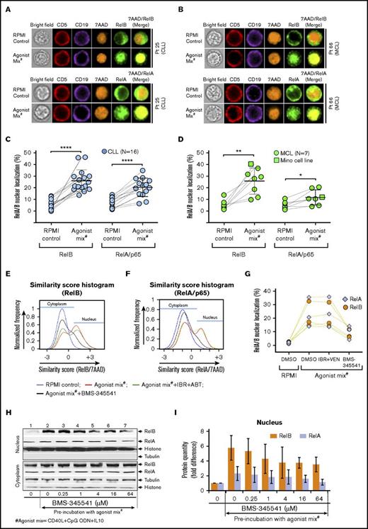 Figure 3. NF-κB pathway is activated in CLL and MCL cells preincubated with agonist mix. CLL and MCL patient PBMCs were preincubated with agonist mix for 12 hours. At the end of 12 hours, a second dose of agonist mix was added and incubated for another 6 hours. Cytoplasmic and nuclear localization of RelB or RelA in a minimum of 500 live/CD5+/CD19+ cells in CLL and MCL samples was analyzed in ImageStream using IDEAS ImageStream analysis software. (A-B) Representative images showing CD5 (red), CD19 (violet), RelB (green), 7AAD (orange), and 7AAD/RelB in CLL (A; top panel) and MCL (B; top panel) patient PBMCs or CD5 (red), CD19 (violet), RelA (green), 7AAD (orange), and 7AAD/RelA in CLL (A; bottom panel) and MCL (B; bottom panel) patient PBMCs. Original magnification ×60. (C-D) Percentage of nuclear localization of RelB and RelA in 16 CLL patient PBMCs (Pts 01-03, 7, 12, 21, 25-28, 33, 35, 43, 46, 51, and 52) (C) and 7 MCL patient PBMCs (Pts 23, 38, 45, 49, 55, 60, and 66) and Mino cells (D) preincubated with or without agonist mix. (E-G) CLL patient PBMCs (N = 3) were incubated with agonist mix for 12 hours and treated with BMS-345541 (16 μM) or IBR (0.1 μM) + VEN (25 nM) as well as a second dose of agonist mix for another 6 hours. The representative image of similarity score histograms showing shift in RelB (E) or RelA (F) colocalization with 7AAD. Percentage of nuclear localization of RelB and RelA in different treatment groups (G). (H-I) Mino cell line preincubated with agonist mix for 12 hours and treated with BMS-345541 (0-64 μM) and a second dose of agonist mix for another 6 hours. RelA, RelB, histone (H3), and tubulin proteins in cytoplasmic and nuclear fractions were analyzed by western blot (H). Bar graphs showing relative band densities of RelB and RelA proteins in the nuclear fractions (I). The data were average from 2 independent experiments. RelB and RelA in nuclear fractions were normalized to histone. Data are expressed as means ± SD. The statistical significance was determined by the paired Student t test. *P < .05, **P < .01, ****P < .0001.