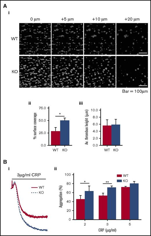 Figure 5. Platelets from DAPP1−/− mice are hyperresponsive to collagen-driven functional responses. (A) Whole blood from WT or DAPP1−/− (KO) mice was loaded with DIOC6 and flowed over collagen (1000 s−1, 3 min) before fixation and imaging by confocal microscopy; (i) representative images of z-slices at indicated intervals relative to the thrombus base; (ii) histogram of surface coverage; (iii) histogram of thrombus height. n = 5 + standard error of the mean. (B) CRP-mediated platelet aggregation in WT and DAPP1−/− mouse platelets; (i) representative aggregation trace; (ii) histogram of the percentage of aggregation in response to a range of indicated CRP concentrations. n = 6 + standard error of the mean. Statistical analyses were performed by using Student t tests (A) or 2-way analysis of variance with Bonferroni post-tests (B). *P < .05; **P < .001.