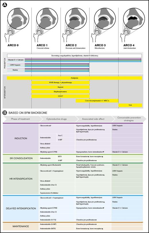 Figure 2. Overview of conceivable pharmacological, nonpharmacological, nonsurgical, and surgical (combined with cellular therapies) potential prevention and intervention options in children and adolescents with ALL. (A) The illustrations depict examples according to the association research circulation osseous (ARCO) classification for the hip joints. Screening of underlying coagulopathies and hyperlipidemia to prevent progression of early-stage ON and eventual compensation of vitamin D deficiency may be considered. The colored arrows indicate in which treatment phases and ON stages the depicted prevention strategies might be effective. (B) Overview of conceivable preventive pharmacological interventions in children and adolescents with ALL assigned to the different phases of the Berlin Frankfurt Muenster (BFM) therapy backbone and the cytostatic drugs and the treatment-related metabolic side effects. CPM, cyclophosphamide; HR, high risk; MP, mercaptopurine; MTX, methotrexate; NWB, non–weight-bearing; SR, standard risk; TG, thioguanine; THA, total hip arthroplasty.