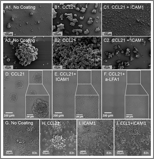 Figure 2. Substrate-immobilized ICAM1, with or without CCL21, reduces T-cell clustering and induces their spreading on surfaces. (A1-C2) Representative scanning electron micrographs, showing T-cell clusters formed in cultures without surface coating (A1, A2) and in cultures with CCL21 coating (B1, B2) or CCL21+ICAM1 coating (C1, C2). Note that ICAM1 coating (C1, C2) induces cell spreading, resulting in significantly smaller and flatter clusters. Scale bars in A1-C1, 100 μm; in A2-C2, 10 μm. (D-F) Transmitted light microscopy images, depicting cell spreading and a decrease in cluster size after their culturing for 72 hours on a surface coated with ICAM1+CCL21 (E), compared with CCL21 alone (D). Addition of anti-LFA1 blocking antibodies to the culture medium of cells on CCL21-coated surfaces inhibits cluster formation (F). Scale bars, 200 μm; white squares show enlarged area in which the scale bar is 100 μm. (G-J) Representative phase contrast images, showing cells 83 hours after their seeding on coated substrates. Note that the ICAM1 surface coating modifies single-cell morphology. Nonclustered cells on an uncoated surface are mostly round, with hardly any cell–cell contacts (G), whereas on CCL21-coated surfaces, cells commonly display an elongated morphology (H). On ICAM1-coated surfaces, the majority of the cells are elongated, with multiple cell–cell contacts (I, J). Scale bars, 50 μm (supplemental Video 2).