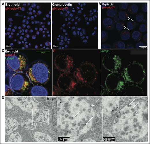 Figure 1. Lysosomal trafficking of transferrin in erythroid progenitors. (A) Fluorescence microscopy of human erythroid and granulocytic progenitors undergoing pHrodo Red-transferrin uptake (confocal image obtained with 20× objective). (B) Fluorescence microscopy at higher magnification of erythroid progenitors undergoing pHrodo Red-transferrin uptake (confocal image with 63× objective; arrows denote perinuclear clustered vesicles). (C) Fluorescence microscopy for colocalization of Alexa Fluor 594-transferrin with endogenous Lamp1 in erythroid progenitors (confocal image with 63× oil objective). Yellow denotes merge between separate red and green channels. (D) Transmission electron microscopy of erythroid progenitors undergoing 10 nm gold-conjugated transferrin uptake, with boxed regions expanded to highlight MVB/lysosomal accumulation of transferrin particles (arrows denote representative gold-conjugated transferrin particles).