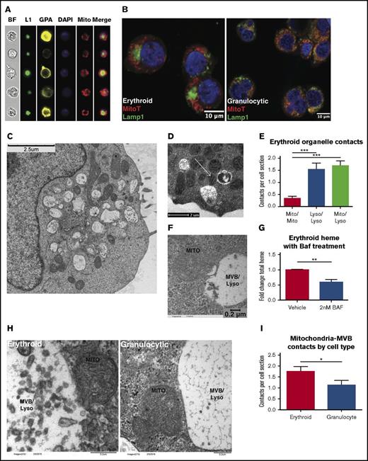 Figure 3. Direct membrane contacts sites between erythroid mitochondria and lysosomes. (A) Imaging flow cytometry showing bright field (BF), glycophorin A (GPA), mitochondria (Mito), nuclei (DAPI), and Lamp1 (L1) in erythroid progenitors. (B) Fluorescence microscopy for Lamp1 and MitoTracker Deep Red FM in erythroid and granulocytic progenitors (confocal image with 63× oil objective, subjected to additional magnification). (C) Transmission electron microscopy of erythroid progenitors. (D) Transmission electron microscopy of erythroid progenitors. Arrow denotes contorted mitochondrion in direct contact with 2 MVB/lysosomes. (E) Quantification of membrane contacts observed by transmission electron microscopy of erythroid progenitors as in (D) (number of cells counted = 48 per group; ***P < .001). (F) Transmission electron microscopy of erythroid progenitors subjected to 10 nm gold-conjugated transferrin uptake, with micrograph depicting mitochondria in direct contact with transferrin-laden MVB/lysosome. (G) Total heme content in erythroid progenitors ± overnight treatment with 2 nM Bafilomycin (BAF; n = 4 per group; **P < .01). (H) Transmission electron microscopy of erythroid and granulocytic progenitors highlighting proximity of mitochondria to MVB/lysosome. (I) Quantification of mitochondria-MVB/lysosome membrane contacts observed by transmission electron microscopy of erythroid and granulocytic progenitors as in (H) (number of cells counted = 48-53 per group; *P < .05).