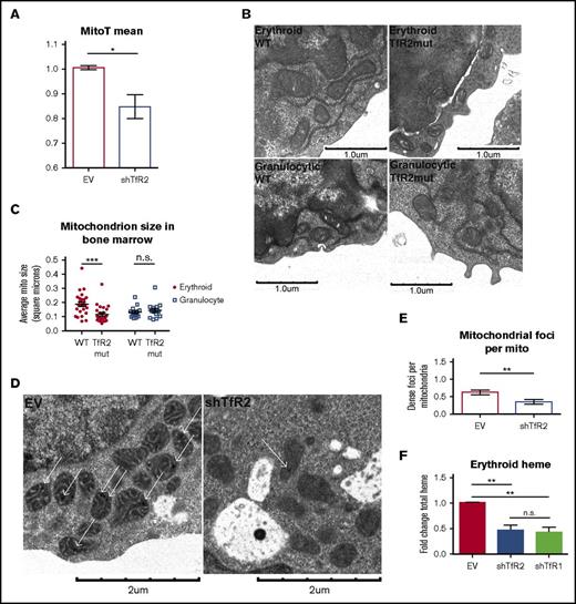 Figure 4. TfR2 is required for erythroid mitochondrial integrity. (A) Summary of imaging flow cytometry studies showing relative MitoTracker Deep Red FM mean fluorescence intensities in lentiviral-transduced K562 cells (n = 4; *P < .05). (B) Transmission electron microscopy of bone marrow from adult wild-type and Tfr2Y245X mutant mice, depicting erythroid progenitors (top) and granulocytic progenitors (bottom). (C) Ultrastructural quantitation of mean mitochondrial size in erythroid and granulocytic progenitors from wild-type and Tfr2Y245X bone marrow as in (B) (number of cells analyzed = 15-23 per group; ***P < .001; ns, not significant). (D) Transmission electron microscopy of erythroid progenitors transduced with lentiviral shRNA constructs. (E) Ultrastructural enumeration of electron-dense foci per mitochondrion in transduced erythroid progenitors as in (D) (number of cells analyzed = 10-13 per group; *P < .05). (F) Total heme content in erythroid progenitors transduced with lentiviral shRNA constructs (n = 3 per group; **P < .01). EV, empty vector.