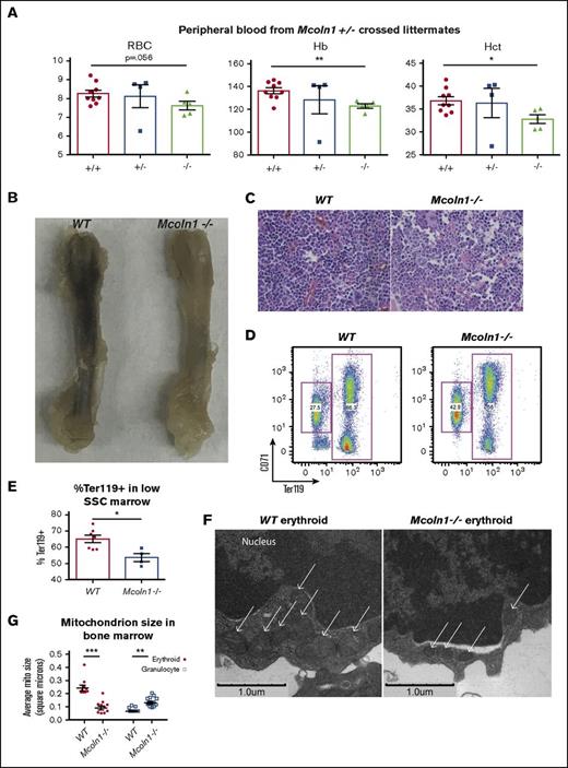 Figure 5. The lysosomal iron channel Mucolipin-1 contributes to erythropoiesis and mitochondrial integrity. (A) Circulating red blood cell counts, hemoglobin concentration (Hb), and hematocrit (Hct) in littermate adult wild-type, Mcoln1+/−, and Mcoln1−/− mice (n = 9 per group; *P < .05, **P < .01). (B) Femur images from adult wild-type and Mcoln1−/− mice. (C) Light micrographs of hematoxylin and eosin–stained bone marrow from adult wild-type and Mcoln1−/− mice (40× objective). (D) Flow cytometry of wild-type and Mcoln1−/− bone marrow erythroid progenitors to assess erythroid differentiation. (E) Summary of flow cytometry studies as in panel D, showing decrease in percentage of Ter119+ cells in low SSC-gated Mcoln1−/− bone marrow (n = 4-8 per group; *P < .05). (F) Transmission electron microscopy of bone marrow depicting marrow erythroid progenitors from adult wild-type (left) and Mcoln1−/− (right) mice; arrows denote mitochondria. (G) Ultrastructural quantitation of mean mitochondrial size in erythroid and granulocytic progenitors from wild-type and Mcoln1−/− bone marrow as in (F) (number of cells analyzed = 10 per group; ***P < .001; **P < .01).