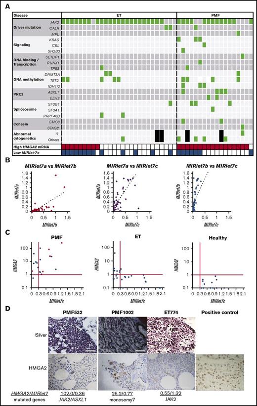 Figure 6. High HMGA2 mRNA levels in patients with PMF are correlated with either repressed MIRlet-7 expressions or mutations in PRC2 components. (A) Mutations in the patients with ET (N = 27) and PMF (N = 18). Black squares indicate no metaphase cells in the chromosomal analysis. (B) Correlations in the expression of MIRlet-7a, -7b, and -7c in granulocytes of the patients with ET and PMF. MIRlet-7a vs -7b, R = 0.70 (left); MIRlet-7a vs -7c, R = 0.74 (center); MIRlet-7b vs -7c, R = 0.85 (right) (R indicates correlation coefficients). (C) Correlations in the expression levels of MIRlet-7c and HMGA2 mRNA in the granulocytes of individual patients. The red lines indicate the lower (MIRlet-7c) or upper (HMGA2) limit of the normal range determined according to the data of the healthy controls (see “Materials and methods”). Red circles indicate the patients with mutations in PRC2-related EZH2 and ASXL1, and a rhomboid denotes a patient with monosomy 7 involving EZH2. (D) Immunostaining of biopsied BM. The nuclei of megakaryocytes from 2 PMF patients with high expression of HMGA2 were positively stained by anti-HMGA2 antibody; those of the ET patient with low expression of HMGA2 were not stained. The tissue from breast cancer, in which the nuclei of neoplastic cells were positively stained, was used as a positive control. Scale bars indicate 50 μm.