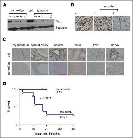 Figure 1. Tamoxifen-induced systemic thrombomodulin ablation in adult mice. (A-B) Residual expression of Thbd antigen detected in the lungs by western blot analysis of tissue lysate (A) and on histological sections (B). Numbers in panels A and B identify individual animals. (C) Detection of Thbd protein by immunohistochemistry in various tissues of tamoxifen-treated ERCreThbdloxP mice. Brown staining indicates Thbd protein detected by horseradish peroxidase–coupled anti-Thbd antibody. Hematoxylin counterstain. Red bars indicate 50 μm. In several animals, Thbd antigen was virtually undetectable. (D) Kaplan-Meier survival plot of ERCreThbdloxP mice after tamoxifen treatment at 8 to 10 weeks. Difference in survival between groups is significant (Mantel-Cox log-rank analysis). Ctrl, non–tamoxifen-treated mice.
