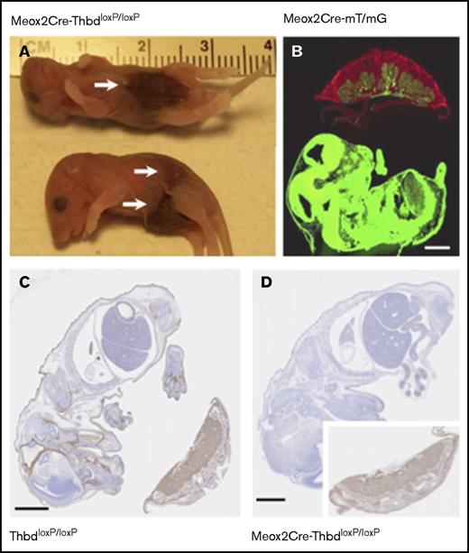 Figure 2. Constitutive Thbd ablation with selective preservation in the placenta in Meox2Cre-ThbdloxP mice. (A) Thbd-deficient neonates found dead. Arrows indicate hemorrhagic lesions. (B) Photomicrograph of a flash-frozen section prepared from a day 15.5 embryo expressing the Meox2Cre-gene and the mT/mG recombinase reporter gene: red (mT) fluorescence indicates the nonrecombined reporter gene expressed in the placenta, green fluorescence indicates Cre-mediated activation of the mG reporter in the embryo proper, chorionic plate, and fetal blood vessels in the placenta, but lack thereof in all extraembryonic fetal trophoblast cells. (C-D) Immunohistochemical detection of Thbd antigen (brown staining; hematoxylin counterstain) in the day 12 embryo and placenta of ThbdloxP mice (in panel C, Thbd is detected in the embryo and placenta) and Meox2Cre-ThbdloxP mice (in panel D, Thbd is present in the placenta, but not the embryo). Scale bars, 1 mm.