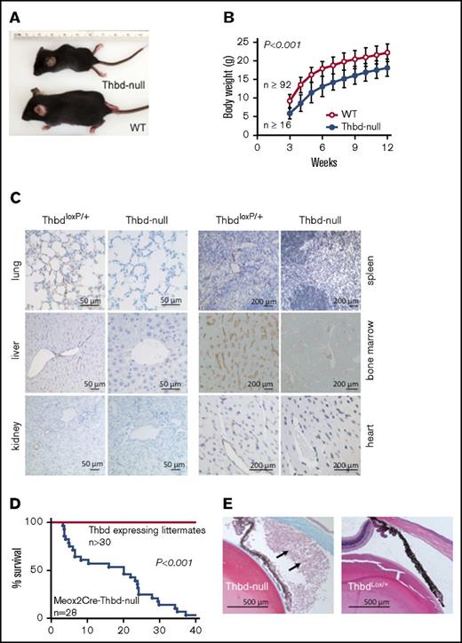 Figure 3. Adult phenotype of Meox2Cre-Thbd-null mice. (A) Smaller body size of Thbd-null mice. (B) Thbd-null mice had significantly lower body weight at all time points measured (n ≥ 16 for each time point), but showed near-normal growth as compared with Thbd-expressing littermates (n ≥ 92 for each time point). (C) Histological immunostaining of different organs at 10 to 16 weeks of age showing persistent absence of Thbd from the endothelium in different vascular beds. (D) Kaplan-Meier survival plot of live-born Meox2Cre-Thbd-null mice (n = 28), as compared with Thbd-expressing littermates of various genotypes. (E) Masson-Trichrome–stained section of affected eye in a Meox2Cre-Thbd-null mouse showing leukocyte infiltration into the anterior eye chamber (left); normal eye histology in a ThbdloxP/+ (1 loxP-flanked but nondeleted Thbd allele and 1 wild-type Thbd allele) (right); hematoxylin and eosin stain.