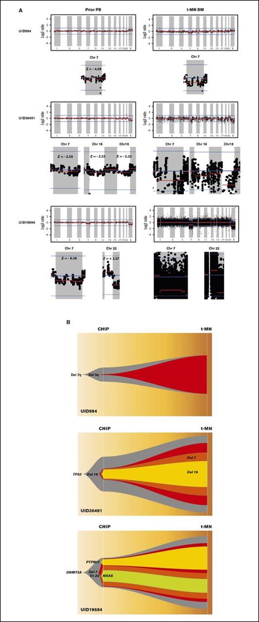 Figure 1. Analysis of CNAs in 3 patients with t-MNs. (A) CNAs detected in t-MN BM samples and matching prior PB samples from each patient. Vertical axis represents log2 ratio of copy number, and horizontal axis represents each chromosome. Y chromosome is not shown because 295-gene panel sequencing does not have enough coverage to analyze CNA in the chromosome. Each chromosome area that showed statistically significant CNA is magnified below, and z score is indicated. (B) Inferred model of clonal architecture and evolution from CHIP to t-MNs. Model was generated based on the estimated clonal fraction of CNAs and point mutations. Chr 7, chromosome 7.