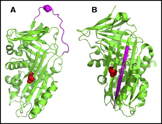 Figure 4. Representative structure of the protein Z–dependent protease inhibitor (SERPINA10) showing the 3-dimensional orientation of residue Q384 (in red) and the reactive center loop (RCL, in pink). The protein model was created using PyMOL (PDB codes: 3H5C for native and 4AFX for RCL-inserted forms). (A) The native protein. (B) Binding of a target protease to the RCL results in cleavage and insertion of the RCL into the central β-sheet.