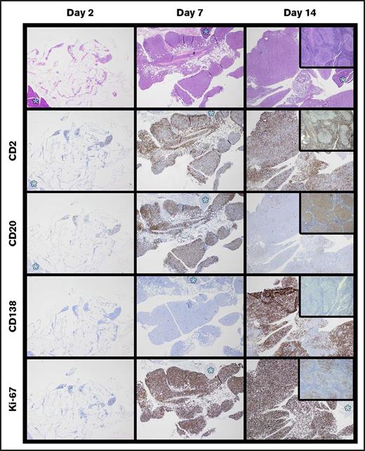 Figure 5. Time course of specimen J (FL) xenograft development demonstrates abrupt plasma cell differentiation between 7 and 14 days. A total of 1 × 107 cells of specimen J were implanted in each of 6 mice; 2 mice were harvested at 2, 7, and 14 days (H&E stained). Ki67 staining was low at day 2, similar to the level in the original excised node (see insets on far right). Numbers of Ki67-positive cells increased by day 7, with a simultaneous increase in both T cells (CD2) and B cells (CD20). Between days 7 and 14, there was an abrupt loss of CD20 expression with appearance of CD138-positive forms. Note that CD138-positive forms were not present in the original biopsy (see inset). Tissue marked with asterisks are pancreas; original magnification of all images ×40.