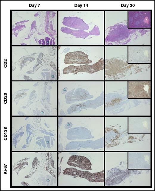 Figure 6. Time course of specimen W (MZL) xenograft development demonstrates abrupt plasma cell differentiation between 1 and 2 weeks. A total of 1 × 107 cells of specimen W were implanted in each of 6 mice; 2 mice were harvested at 7, 14, and 30 days (H&E stained). By day 7, T cells (CD2+) were more abundant in the graft than in the original specimen, and B cells (CD20+) were relatively less abundant. Plasma cells (CD138+) appeared between days 14 and 30. In contrast to specimen J, the CD20+ cells of specimen W coexist with the CD138+ forms. Furthermore, there was a consistent peripheral distribution of the plasma cells (see day 30, CD138). By day 30, the Ki67 appears to be decrementing. Tissue marked with asterisks are pancreas; original magnification of all images ×40.