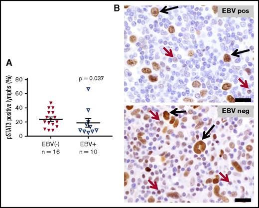 Figure 6. Expression of phosphorylated STAT3 in EBV+ vs EBV− CHL. Nuclear pSTAT3 expression was detected with IHC. HRS tumor cells in both EBV+ and EBV− specimens expressed pSTAT3 robustly at equivalent levels (P value not significant). (A) However, infiltrating lymphocytes in EBV− specimens overexpressed pSTAT3, consistent with gene expression profiling results (P = .037, by a 1-sided Wilcoxon rank sum test). Horizontal black lines indicate the mean and the mean ± standard error of the mean. (B) Representative photomicrographs from EBV+ and EBV− CHL specimens stained with anti-pSTAT3. Black arrows, HRS tumor cells; red arrows, lymphocytes. Slides were imaged at ×500 magnification with an aperture of 0.9. Bar, 20 μm.