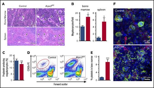 Figure 2. Premature platelet release into the bone marrow compartment in Arpc2fl/flPF4-Cre mice. (A) Increased megakaryocyte density in representative images of bone marrow and spleen sections stained with hematoxylin and eosin. (B) Quantification of megakaryocyte density in indicated organs (8-13 random fields analyzed per organ; n = 3). (C) Percentage of proplatelet forming bone marrow megakaryocytes observed in culture (n = 7-8). (D) Representative flow cytometry dot plots showing increased number of platelet-sized CD42b+ particles in bone marrow from Arpc2fl/flPF4-Cre mice. (E) Quantification of CD42b+ particles in bone marrow (n = 6). (F) Representative confocal fluorescence images of bone marrow from the indicated mice. Green, megakaryocytes/platelets; red, endothelial cells/vasculature; blue, nuclei; blue bars, control; red bars, Arpc2fl/flPF4-Cre. Data presented as mean ± SEM, *P < .05, ***P < .001.