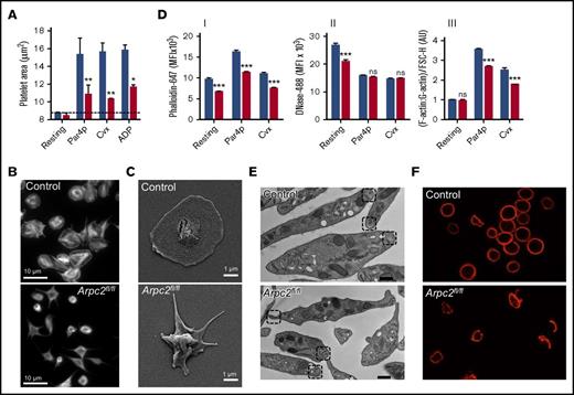 Figure 5. Altered actin dynamics in Arpc2fl/flPF4-Cre platelets. (A) Quantification of the surface area of unstimulated (resting) or stimulated platelets (500 μM Par4p, 750 ng/mL Cvx, or 10 μM adenosine 5′-diphosphate) spread on fibrinogen for 30 minutes (n = 5). (B) Representative immunofluorescent images of Cvx-stimulated platelets spread on a fibrinogen matrix and stained with phalloidin. (C) Representative scanning electron microscopy images of spread platelets on fibrinogen matrix from indicated mice, stimulated with Cvx (750 ng/mL). (D) Quantification of platelet F-actin (I), G-actin (II), and F-actin:G-actin ratio (III) at resting conditions or after stimulation with Par4p (500 μM) or Cvx (1 μg/mL) for 10 minutes before fixation (n = 5). (E) Representative transmission electron microscopy images of resting platelets from indicated mice; boxes indicate location of intracellular tubulin ring bundles. Scale bar, 200 nm. (B) Representative immunofluorescent images of tubulin rings in resting platelets from indicated mice. Blue bars, control; red bars, Arpc2fl/flPF4-Cre. Data presented as mean ± SEM. *P < .05, **P < .01, ***P < .001.