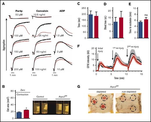 Figure 6. Mild platelet activation defect but intact hemostasis in Arpc2fl/flPF4-Cre mice. (A) Representative traces showing aggregation of platelet rich plasma stimulated with increasing doses of the indicated agonists. (B) Quantification of total clot area after platelet-mediated retraction (n = 3-5) and representative images of retracted clots. (C-D) Tail clip bleeding assay. Time to cessation of bleeding (C) and amount of blood loss (D) from severed tails of the indicated mice (n = 11-12). (E) Time to occlusion of carotid artery after induction of thrombosis by administration of FeCl3 solution to vessel (n = 8-9). (F) Kinetics of platelet accumulation and peak platelet density at injury site of saphenous vein after laser ablation (8 total injury sites per group; 3 mice per group). (G) Representative images of intradermal bleeding at sites of local inflammation induced by rPA reaction in platelet depleted and nondepleted Arpc2fl/flPF4-Cre mice (n = 3 mice). Blue/black bars/lines, control; red bars/lines, Arpc2fl/flPF4-Cre). Data presented as mean ± SEM. *P < .05.