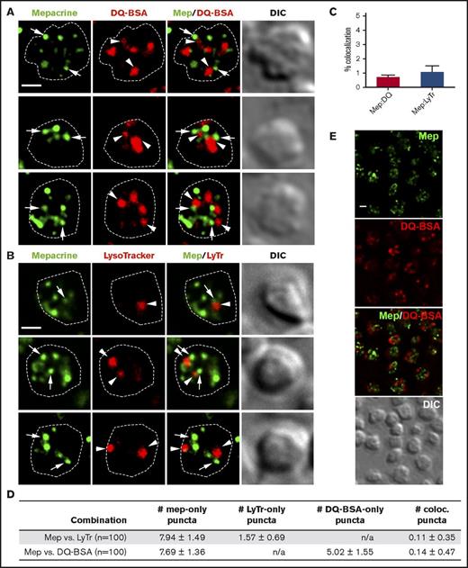 Figure 1. Mepacrine accumulates in structures distinct from lysosomes in platelets. (A-B) Shown are deconvolved, single-plane images from a z-series image stack of 3 individual platelets labeled with each combination individually or together (merge), along with a corresponding differential interference contrast image (DIC). Puncta are labeled by mepacrine (arrows) or by DQ BSA or LysoTracker (arrowheads). The cell outline is based on the DIC image (white dotted line). Scale bars, 1 μm. Platelets were incubated with 50 μM mepacrine (green) and either 10 μg/mL DQ BSA (red; A) or 200 nM LysoTracker Red DND-99 (red; B) for 30 min and analyzed by fluorescence microscopy. (C-D) Quantification of both the degree (mean ± SD) of mepacrine colocalization with DQ BSA or LysoTracker (N = 105 platelets each from 3 individual experiments) and the number of puncta per platelet (mean ± SD) labeled by mepacrine alone (#mep-only), LysoTracker alone (#LyTr-only), DQ BSA alone (#DQ-BSA-only) or by both mepacrine/LysoTracker or mepacrine/DQ BSA (# coloc.). (E) Shown is a deconvolved, single-plane image of a field of platelets labeled with mepacrine (Mep, green) and DQ BSA (red) individually or merged, along with corresponding DIC image. Scale bar, 1 μm. Platelets were analyzed by wide field microscopy at room temperature with a Leica DM IRBE equipped with a 100× Plan Apochromat objective lens (1.4 NA), a Hamamatsu Orca Flash 4 digital CMOS camera, and Leica Application Suite software. Imaging medium was modified, calcium-free Tyrode’s buffer. Deconvolution was performed in Leica Application Suite software using Gold’s iterative deconvolution algorithm. Mepacrine has an excitation/emission of 436/525 nm; LysoTracker Red excitation/emission: 577/590 nm; DQ BSA excitation/emission: ∼590/∼620 nm. Coloc., colocalization; DIC, differential interference contrast; LyTr, LysoTracker; Mep, mepacrine; n/a, not applicable.