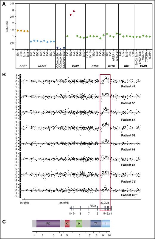 Figure 1. MLPA and SNP6.0 profiles of patients with PAX5AMP. (A) Example of MLPA results using the P335 IKZF1 MLPA kit. The plot shows the probe ratio for each target contained in the kit (EBF1, 4 probes; IKZF1, 8 probes; CDKN2A/B, 3 probes; PAX5, 6 probes; ETV6, 6 probes; BTG1, 4 probes; RB1, 5 probes; and the PAR1 region, CRLF2, CSF2RA, and IL3RA, 1 probe each). Probe ratio values between 0.75 and 1.3 were considered to be within the normal range, equivalent to the normal copy number of 2. Values <0.75 or >1.3 indicated loss or gain, respectively, and a value <0.25 indicated biallelic loss. These values correspond to copy numbers of 1, 3 and 4, and 0, respectively. A value ≥2.0 corresponds to a copy number of ≥4 and was interpreted as amplification. Approximate copy numbers of amplified exons ranged from 4 to 22 (median, 5.86). Ratio values of 1 representative patient (patient 64) showing amplification of PAX5 encompassing exons 2 and 5, gain of EBF1 consistent with trisomy 5 in this patient, monoallelic loss of IKZF1, and biallelic loss of CDKN2A/B. (B) Copy number profiles (log2ratio) of the PAX5 locus of 8 patients with PAX5AMP processed on the SNP6.0 array. *In patient 79, PAX5 amplification was identified at relapse with no material available from diagnosis. **Patient 60 shows amplification of exon 5 only and gain of exons 1 to 4. (C) Exon and protein structure of PAX5; the amplified region encodes the DNA-binding paired domain and the octapeptid motif. PD, paired DNA-binding domain (amino acids 16-142); O, octapeptide (aa 179-186); H, homeodomain (aa 228-254); TA, transactivation domain (aa 304-391); I, inhibitory domain (aa 359-391).