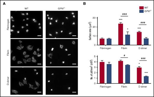 Figure 4. GPVI-dependent platelet spreading on D-dimer. (A) Glass coverslips were coated overnight with fibrinogen, fibrin, or D-dimer. Mouse platelets (ptl; 20 × 109/L) were allowed to spread on coated coverslips followed by staining for actin with Alexa-488 phalloidin. Scale bar, 5 μm. The figure is representative of 3 similar experiments. (B) Quantification of platelet surface area and platelet count per millimeter squared (n = 3). In each independent experiment, 5 random pictures were analyzed (100 platelets in total). The results are shown as mean ± standard deviation. *P < .05, ***P < .001 compared with fibrinogen; #P < .05, ###P < .001 compared with wild type (WT).
