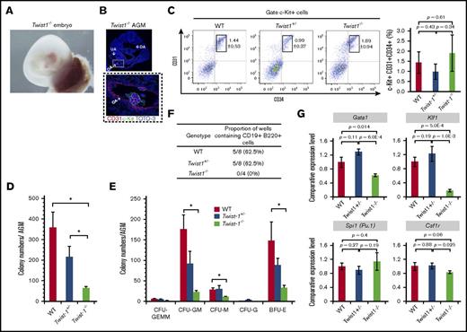 Figure 2. Twist1−/− IACs exhibit impaired hematopoietic differentiation ability. (A) Yolk sac and placenta of Twist1−/− mouse embryo at 10.5 dpc. (B) Immunohistochemistry of AGM tissue in Twist1−/− embryos. Cryosections of 10.5-dpc Twist1−/−AGM were costained with c-Kit (an HSPC marker) and CD31 (an endothelial marker) and observed by confocal microscopy. c-Kit (green), CD31 (red), and TOTO-3 iodide (blue) staining are shown. Higher magnification of OA IACs is shown in dashed box. Confocal images were acquired using a 4× (top) and 40× (bottom) objective lens. (C) Flow cytometric analysis of IACs from 10.5-dpc AGM. Bar graph shows percentage of c-Kit+CD31+CD34+ cells per total cells prepared from the AGM region: WT C57BL/6 mice (n = 2), Twist1+/− mice (n = 2), and Twist1−/− mice (n = 2). (D) HSPC CFUs. Cells were prepared from AGM from indicated genotype embryos and cultured 9 days in semisolid medium containing SCF, IL-3, IL-6, and erythropoietin (Epo). The total number of hematopoietic colonies per AGM is shown. Data shown for each genotype are from 3 embryos (n = 3). *P < .05. (E) The number of each type of hematopoietic colony in indicated genotypes. CFU-GEMM (CFU of granulocytes, erythrocytes, monocytes, and macrophages), CFU-GM (CFU of granulocytes and macrophages), CFU-M (CFU of macrophages), CFU-G (CFU of granulocytes), and BFU-E (burst-forming unit of erythroid). Data shown for each genotype are from 3 embryos (n = 3). *P < .05. (F) In vitro B lymphopoiesis assay. Single cells from AGM were cocultured 14 days with OP9 stromal cells in the presence of IL-7. CD19+B220+ cells were analyzed by flow cytometry. Percentages are defined as the number of culture wells containing CD19+B220+ cells relative to total number of culture wells. (G) Erythroid (Gata1 and Klf1) and myeloid (Spi1 and Csf1r) gene expression analysis of IACs prepared from the WT, Twist1+/−, and Twist1−/− AGM region at 10.5 dpc. Comparative expression levels were calculated using the 2−ΔΔCT method. WT IAC sample served as a reference. Data shown are means ± SD of technical triplicate samples.