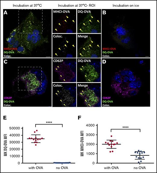 Figure 3. MKs present OVA peptides in MHC class I (MHCI) molecules. After a 60-minute chase, DQ-OVA and anti–MHCI-OVA (binds to the OVA SIINFEKL antigen in the groove of MHC class I molecules) colocalization was tested at 37°C (A) and on ice (B). In the same conditions, DQ-OVA colocalization with the α-granule marker CD62P was measured by confocal microscopy (C-D). DQ-OVA fluorescence and consistently expressed MHCI-OVA level at plasma membrane upon a pulse of 24 hours was determined by flow cytometry (500 µg/mL) (E-F). Unpaired t test; n = 13; mean with SD; ****P < .0001; each n corresponds to an independent MK donor mouse. Original magnification ×63 for panels A-D. Scale bars represent 10 μm, except in ROI images scale bars represent 2 μm.