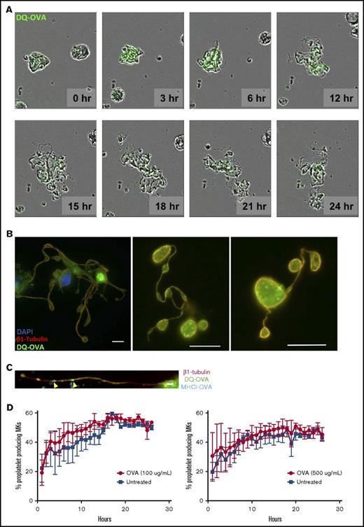 Figure 6. MKs deliver MHC class I complexes containing OVA antigen to proplatelets in vitro. MKs were pulsed with OVA (green) and proplatelet formation (A) was monitored for 24 hours as OVA antigens were gradually packaged into proplatelets during their formation. This observation was confirmed at 24 hours postpulse (B). OVA signal was found in mature proplatelets, presenting the typical β1 tubulin peripheral coil (B). Scale bar represents 10 μM. MHCI-OVA complexes were also transferred to proplatelet during thrombopoiesis (C). Scale bar represents 2 μM. The processing of OVA antigens did not affect MK proplatelet formation (D).