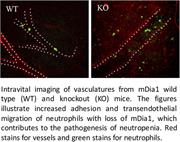 Graphical abstract for: Loss of mDia1 causes neutropenia via attenuated CD11b endocytosis and increased neutrophil adhesion to the endothelium;
