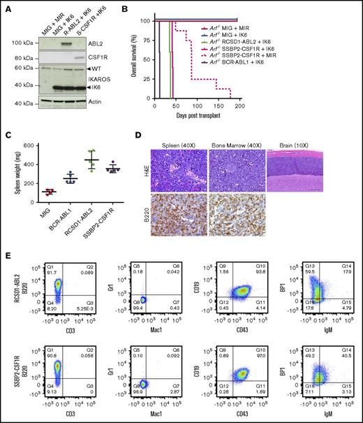 Figure 3. Expression of RCSD1-ABL2 and SSBP2-CSF1R in Arf−/− pre-B cells induces B-ALL in C57Bl/6 mice. (A) Immunoblot of Arf−/− pre-B cells showing expression of ABL2, CSF1R, IKAROS, and actin. (B) Kaplan-Meier curve of sublethally irradiated C576Bl/6 mice receiving Arf−/− pre-B cells by tail vein injection (5 × 105 cells/mouse). (C) Spleen weight of C576Bl/6 mice transplanted with Arf−/− pre-B cells (n = 5). MIG, MSCV-ires-GFP. (D) Bone marrow, spleen, and brain sections from a representative mouse transplanted with Arf−/− pre-B cells stained with hematoxylin and eosin (H&E) or a B220-specific antibody. (E) Analysis of bone marrow of diseased animals by flow cytometry. Immunophenotype is consistent with arrest at the pre-B stage of development.