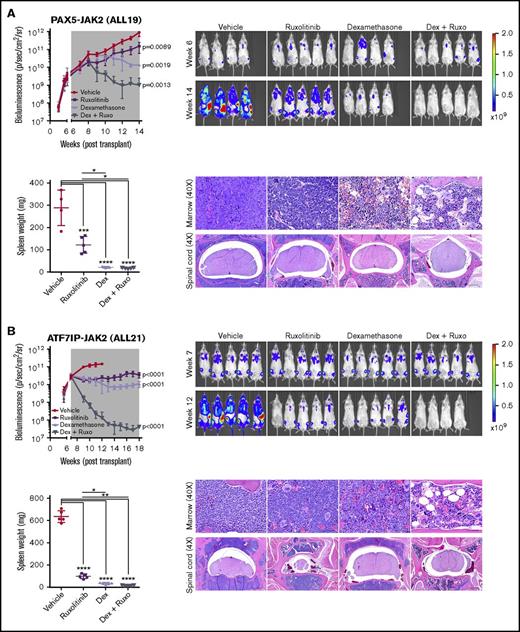 Figure 7. Superior efficacy of ruxolitinib combined with dexamethasone in JAK2-rearranged ALL. NSG mice were injected with primary leukemic cells (A) ALL19 or (B) ALL21. When engraftment reached 1010 p/sec per cm2/steridian on bioluminescent imaging, animals (n = 5) were treated with vehicle, ruxolitinib (provided as chow), dexamethasone (4 mg/mL ad libitum), or ruxolitinib and dexamethasone combined. Treatment length is indicated by the gray shaded area; animals were euthanized at the last time point. Analysis of slope was measured by linear regression and 1-way ANOVA with Tukey posttest for multiple comparisons. Spleen weights were measured at the time of euthanasia. Each point represents the mean ± SD (n = 5). Representative H&E staining of bone marrow and spinal cord of treated mice are shown. *P < .05, **P < .01, ***P < .001, ****P < .0001. Ruxo, ruxolitinib.