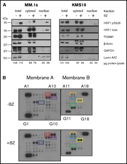 Figure 1. Cytosolic kinases are activated by PIs and phosphorylate HSF1. (A) HSF1 S326 is phosphorylated in the cytoplasm. MM.1s and KMS18 cells were treated with 8 nM bortezomib for 9 hours followed by either total lysis or subcellular fractionation and equal cell number western blot analysis. Data are representative of 4 independent experiments. (B) Human kinome phosphoprotein microarray identifies bortezomib (BZ)–induced targets. MM.1s cells were treated with 8 nM bortezomib for 9 hours. Protein lysis and all subsequent steps were performed using the R&D Systems Human Phospho-Kinase Antibody Array as per manufacturer's instructions. Coordinate pairs and box colors are matched with their respective targets as follows: red, A7/8 = JNK1/2/3; orange, A13/14 = p53 (S392); purple, B9/10 = Akt1/2/3; blue, B13/14 = p53 (S46); black, C5/6 = HSP27; yellow, C15/16 = c-Jun; green, E13/14 = p27. Data are representative of 2 independent experiments.
