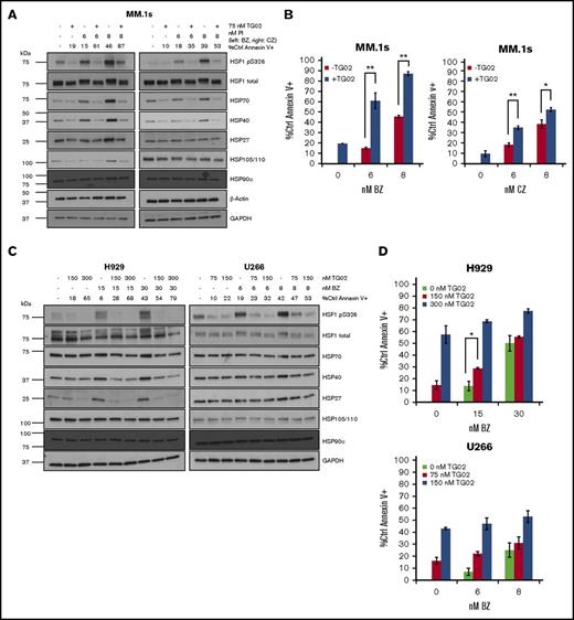 TG02 inhibits PI-induced HSF1 S326 phosphorylation and PI-induced HSR in myeloma cells. (A) MM.1s cells were cotreated with TG02 and either bortezomib (left) or carfilzomib (right). Protein lysates were collected at 9 hours for western blot analysis, and cells were analyzed at 24 hours for apoptosis. Apoptosis was measured by annexin V and PI staining and flow cytometry. Western blot data are representative of 4 independent experiments. (B) TG02 and PI combination leads to an additive effect on apoptosis in MM.1s cells. Experimental setup was as described in panel A. Apoptosis was measured as described previously. P values are calculated by paired Student t test. *P < .05; **P < .01. (C) TG02 inhibits bortezomib-induced HSF1 S326 phosphorylation and bortezomib-induced HSR in H929 cells and HSF1 S326 phosphorylation in U266 cells. H929 or U266 cells were cotreated with TG02 and bortezomib. Western blot data are representative of 4 independent experiments. (D) TG02 and PI combination leads to an additive effect on apoptosis in H929 cells but not U266 cells. Experimental setup was as described in panel C. Apoptosis was measured as described previously. P -values are calculated by paired Student t test. *P < .05; **P < .01. (E) TG02 inhibits carfilzomib-induced HSF1 S326 phosphorylation and bortezomib-induced HSR in patient samples. CD138+ (>90%: PS10001496; >75%: PS10001225-2) cells from freshly isolated patient samples were cotreated with TG02 and carfilzomib. Experimental design as previously. (F) CDK9 is not responsible for bortezomib-induced S326 phosphorylation, and its silencing does not sensitize cells to bortezomib-induced apoptosis. MM.1s cells were treated with a nonsilencing control (-), CDK9 (C), or HSF1 (H) siRNA for 24 hours followed by bortezomib treatment of either an additional 9 hours for western blot analysis (top) or 24 hours for flow cytometry analysis (bottom). Data are representative of 3 independent experiments. Apoptosis was measured as described previously. P values are calculated by paired Student t test. *P < .05; **P < .01.