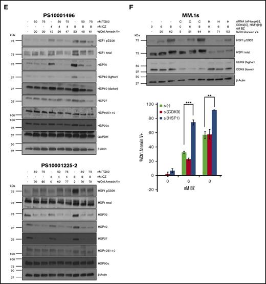 TG02 inhibits PI-induced HSF1 S326 phosphorylation and PI-induced HSR in myeloma cells. (A) MM.1s cells were cotreated with TG02 and either bortezomib (left) or carfilzomib (right). Protein lysates were collected at 9 hours for western blot analysis, and cells were analyzed at 24 hours for apoptosis. Apoptosis was measured by annexin V and PI staining and flow cytometry. Western blot data are representative of 4 independent experiments. (B) TG02 and PI combination leads to an additive effect on apoptosis in MM.1s cells. Experimental setup was as described in panel A. Apoptosis was measured as described previously. P values are calculated by paired Student t test. *P < .05; **P < .01. (C) TG02 inhibits bortezomib-induced HSF1 S326 phosphorylation and bortezomib-induced HSR in H929 cells and HSF1 S326 phosphorylation in U266 cells. H929 or U266 cells were cotreated with TG02 and bortezomib. Western blot data are representative of 4 independent experiments. (D) TG02 and PI combination leads to an additive effect on apoptosis in H929 cells but not U266 cells. Experimental setup was as described in panel C. Apoptosis was measured as described previously. P -values are calculated by paired Student t test. *P < .05; **P < .01. (E) TG02 inhibits carfilzomib-induced HSF1 S326 phosphorylation and bortezomib-induced HSR in patient samples. CD138+ (>90%: PS10001496; >75%: PS10001225-2) cells from freshly isolated patient samples were cotreated with TG02 and carfilzomib. Experimental design as previously. (F) CDK9 is not responsible for bortezomib-induced S326 phosphorylation, and its silencing does not sensitize cells to bortezomib-induced apoptosis. MM.1s cells were treated with a nonsilencing control (-), CDK9 (C), or HSF1 (H) siRNA for 24 hours followed by bortezomib treatment of either an additional 9 hours for western blot analysis (top) or 24 hours for flow cytometry analysis (bottom). Data are representative of 3 independent experiments. Apoptosis was measured as described previously. P values are calculated by paired Student t test. *P < .05; **P < .01.