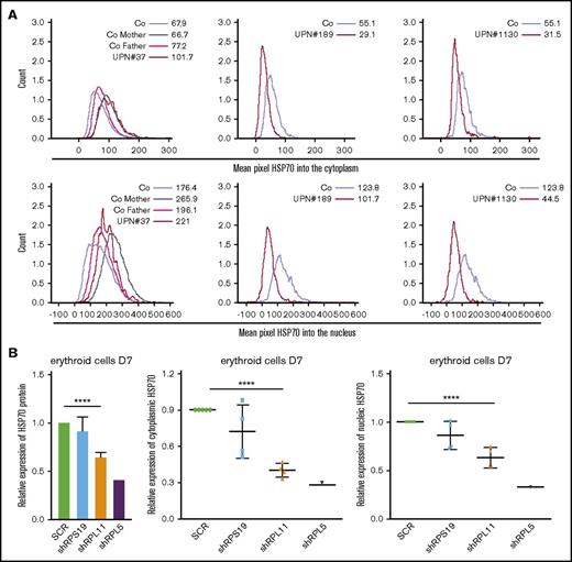 Figure 2. HSP70 expression level and subcellular localization measured by imaging flow cytometry (ImageStream) in human erythroid cells from various DBA patients and after RPS19 or RPL11 or RPL5 depletion of primitive CD34+ cord blood cells. (A) HSP70 expression level measured by imaging flow cytometry (ImageStream) into the cytoplasm (top panels) and nucleus (bottom panels) in erythroid cells from DBA-affected patients (RPS19+/Mut UPN#37, RPL11+/Mut UPN#189 and UPN#1130 patients) and relatives (Co mother and father) at day 7 of culture compare with healthy controls (Co). Results are presented as the mean fluorescence intensity (MFI). (B) HSP70 expression analysis compared with actin in the shRNA model using imaging flow cytometry in the total erythroid cells and in the cytoplasm and nucleus of these cells (ImageStream). The data are shown as the mean ± the standard deviation of 4 independent experiments. RPL5 shown as another non RPS19 gene. ****P < .0001.
