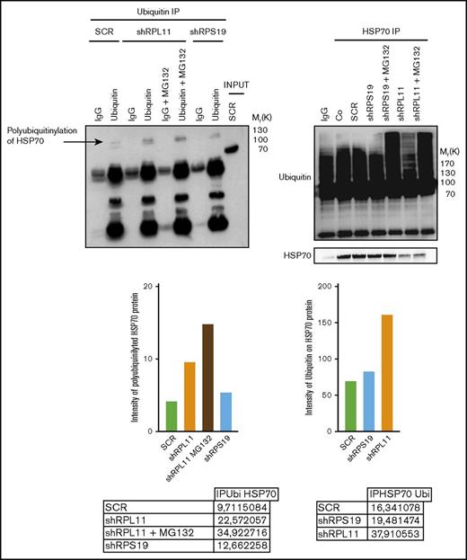 Figure 6. HSP70 is ubiquitinated in RPL11 invalidated cells before proteasomal degradation. Left panel: Immunoprecipitation (IP) of ubiquitinated stained proteins (ubiquitin lanes) compared with the immunoprecipitation with an immunoglobulin G (IgG) control antibody (IgG lanes) in UT-7 cells cultured under EPO and infected with either the shRPS19 or the shRPL11, compared with the SCRamble (shSCR). Proteins after immunoprecipitation have been revealed with an antibody against HSP70. shRPL11 cells were treated or not with MG132 at 10 µM for 5 hours. HSP70 expression has been analyzed in the total cell lysate (INPUT) to validate that the HSP70 protein is present in all the studied samples. IgG lane: IgG control antibody; ubiquitin lane: anti-ubiquitin specific antibody in order to immunoprecipitate the ubiquitinated proteins; IgG+MG132 lane: IgG control antibody immunoprecipitation after cell treatment with the proteasome inhibitor, MG132; ubiquitin+MG132: anti-ubiquitin specific antibody for ubiquitinated proteins after cell treatment with the proteasome inhibitor, MG132. Right panel: Immunoprecipitation of HSP70 stained protein. The proteins have been then revealed by an antibody against ubiquitin (top of the western blot) and against HSP70 (bottom of the western blot) in UT-7 cells cultured under EPO and infected with either the shRPS19 or the shRPL11, compared with the SCRamble (shSCR) and noninfected cells (Co). These cells were also treated or not with MG132 at 10 µM for 5 hours. IgG lane: IgG control antibody; HSP70 IP lanes: HSP70 specific antibody in order to immunoprecipitate HSP70 proteins in depleted RPS19, RPL11 after or not MG132 cell treatment and compare with the SCRamble (shSCR) and noninfected cells (Co).